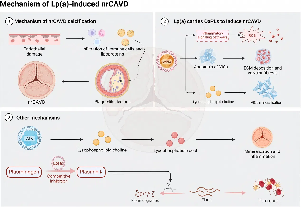 图3. Lipoprotein(a) 与非风湿性钙化性主动脉瓣疾病：Lp(a) 对 nrCAVD 发病机制的影响